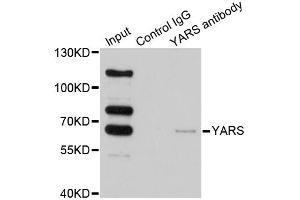 Immunoprecipitation analysis of 200ug extracts of HeLa cells using 1ug YARS antibody. (YARS Antikörper)
