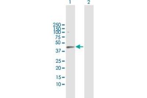 Western Blot analysis of HDAC8 expression in transfected 293T cell line by HDAC8 MaxPab polyclonal antibody. (HDAC8 Antikörper  (AA 1-377))