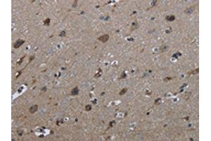 The image on the left is immunohistochemistry of paraffin-embedded Human brain tissue using ABIN7129446(FAM89B Antibody) at dilution 1/30, on the right is treated with fusion protein. (FAM89B Antikörper)