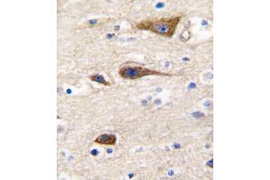 Formalin-fixed and paraffin-embedded human brain tissue reacted with CYP2R1 antibody (Center), which was peroxidase-conjugated to the secondary antibody, followed by DAB staining. (CYP2R1 Antikörper  (AA 152-180))