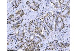 IHC analysis of MCM7 using anti-MCM7 antibody (ABIN7601968). (MCM7 Antikörper  (AA 526-719))