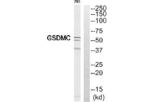Western blot analysis of extracts from 293 cell, using GSDMC antibody. (MLZE Antikörper  (Internal Region))