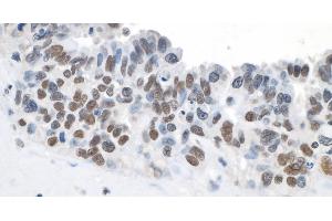 Immunohistochemistry (IHC) image for anti-Topoisomerase (DNA) II beta 180kDa (TOP2B) (C-Term) antibody (ABIN7454697) (TOP2B Antikörper  (C-Term))