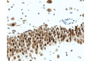 Immunohistochemistry: Rat hippocampus, formalin-fixed paraffin-embedded tissue, with citrate pre-treatment (20X magnification). (BDKRB2 Antikörper  (AA 350-364))