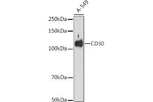 Western Blotting (WB) image for anti-Tumor Necrosis Factor Receptor Superfamily, Member 8 (TNFRSF8) antibody (ABIN7271072)