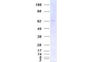 Western Blotting (WB) image for Protein Kinase C, iota (PRKCI) protein (Myc-DYKDDDDK Tag) (ABIN2729628)