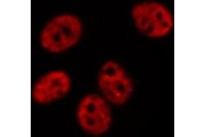 ABIN6275070 staining  Hela cells by IF/ICC. (POLR1B Antikörper  (Internal Region))