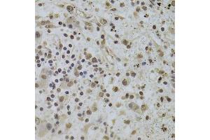 Immunohistochemistry (Paraffin-embedded Sections) (IHC (p)) image for anti-Integrator Complex Subunit 6 (INTS6) (AA 1-280) antibody (ABIN6142494)