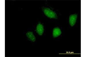 Immunofluorescence of purified MaxPab antibody to LYN on HeLa cell.