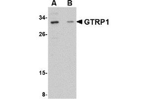 Western Blotting (WB) image for anti-Growth Hormone Regulated TBC Protein 1 (GRTP1) (Middle Region) antibody (ABIN1030945) (GRTP1 Antikörper  (Middle Region))
