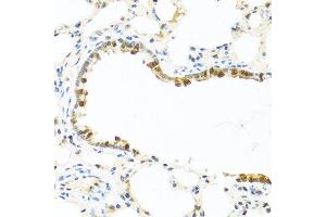 Immunohistochemistry of paraffin-embedded rat lung using APCS antibody at dilution of 1:100 (40x lens).