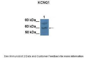 Lanes:   100 ug CHO cell lysate  Primary Antibody Dilution:   1:1000  Secondary Antibody:   Goat anti-rabbit HRP  Secondary Antibody Dilution:   1:25000  Gene Name:   KCNQ1  Submitted by:   Anonymous (KCNQ1 Antikörper  (N-Term))