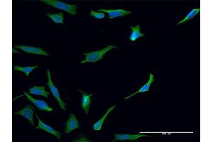 Immunofluorescence of monoclonal antibody to TGM2 on HeLa cell. (Transglutaminase 2 Antikörper  (AA 1-120))