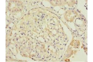 Immunohistochemistry of paraffin-embedded human kidney tissue using ABIN7149924 at dilution of 1:100 (DPYS Antikörper  (AA 250-519))