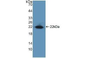 Western blot analysis of recombinant Human EGR1. (EGR1 Antikörper  (AA 282-433))