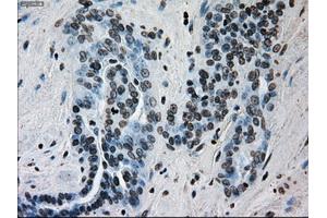 Immunohistochemical staining of paraffin-embedded Kidney tissue using anti-ERCC1 mouse monoclonal antibody. (ERCC1 Antikörper)