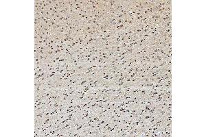 IHC analysis of SNRPA1 using anti-SNRPA1 antibody (ABIN7599131). (SNRPA1 Antikörper  (AA 1-233))