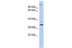 ARPC2 antibody used at 1 ug/ml to detect target protein. (ARPC2 Antikörper  (N-Term))