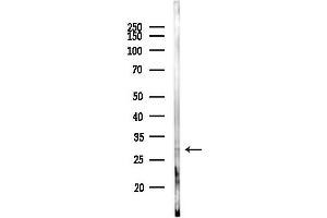 anti-Ubiquitin-Conjugating Enzyme E2E 3 (UBE2E3) (N-Term) antibody