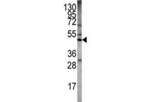 Western Blotting (WB) image for anti-serine/threonine Kinase 11 (STK11) (AA 19-48) antibody (ABIN3032541)