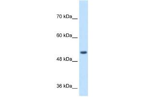 WB Suggested Anti-SPPL2B Antibody Titration:  1 ug/ml  Positive Control:  Jurkat cell lysate SPPL2B is supported by BioGPS gene expression data to be expressed in Jurkat