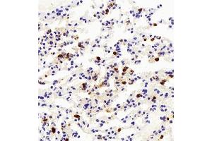Immunohistochemistry of paraffin embedded mouse lung+LPS using LY6G (ABIN7074524) at dilution of 1:500 (400x lens) (Ly6g Antikörper)