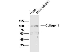 Lane 1: U2os lysates Lane 2: MDA-MB-231 lysates probed with Collagen II Polyclonal Antibody, Unconjugated  at 1:300 dilution and 4˚C overnight incubation. (COL2 Antikörper  (AA 1401-1487))