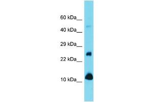 Western Blotting (WB) image for anti-Vesicle-Associated Membrane Protein 1 (Synaptobrevin 1) (VAMP1) (N-Term) antibody (ABIN2789441) (VAMP1 Antikörper  (N-Term))