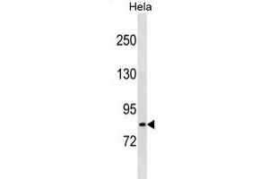 LRCH1 Antibody (Center) (ABIN1881505 and ABIN2839080) western blot analysis in Hela cell line lysates (35 μg/lane).