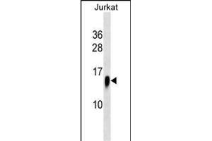 ATP6V1F Antibody (C-term) (ABIN1537610 and ABIN2838177) western blot analysis in Jurkat cell line lysates (35 μg/lane). (ATP6V1F Antikörper  (C-Term))