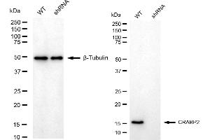 Western blotting analysis using CRABP2 antibody (ABIN7798022). (Rekombinanter CRABP2 Antikörper)