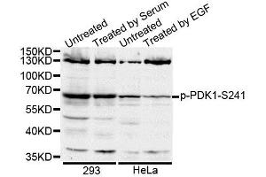 Western blot analysis of extracts of various cell lines, using Phospho-PDK1-S241 antibody (ABIN5995588). (PDPK1 Antikörper  (pSer241))