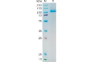 Human PSMA Protein, His Tag on SDS-PAGE under reducing condition.
