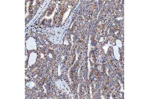 IHC analysis of SFXN5 using anti-SFXN5 antibody (ABIN7601388). (Sideroflexin 5 Antikörper  (AA 34-340))