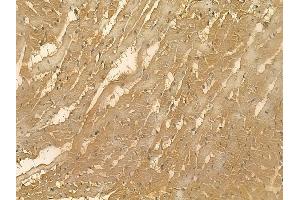 TNNI2 Mouse Monoclonal Antibody at 1/100 staining rat heart tissue by IHC-P. (TNNI2 Antikörper)