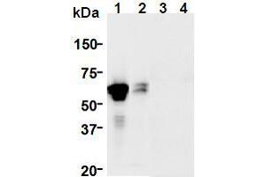 Western Blotting (WB) image for anti-GDNF Family Receptor alpha 1 (GFRA1) (AA 24-440), (Extracellular Domain) antibody (ABIN1449285) (GFRA1 Antikörper  (Extracellular Domain))