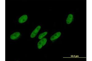 Immunofluorescence of purified MaxPab antibody to ZNF777 on HepG2 cell. (ZNF777 Antikörper  (AA 1-518))