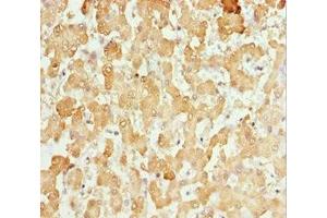 Immunohistochemistry of paraffin-embedded human liver tissue using ABIN7146127 at dilution of 1:100 (CXCL14 Antikörper  (AA 35-111))