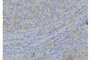 ABIN6273365 at 1/100 staining Human gastric tissue by IHC-P. (NDUFA10 Antikörper  (C-Term))