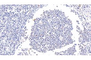 Detection of CD11b in Human Tonsil Tissue using Polyclonal Antibody to Integrin Alpha M (CD11b) (CD11b Antikörper  (AA 301-451))