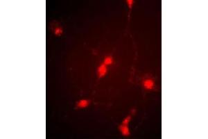 Immunofluorescence image of cultured chick retinal amacrine (neuronal) cells labeled with CLC4 Antibody (C-term) (Cat  f).
