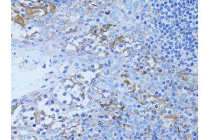 Immunohistochemistry of paraffin-embedded human tonsil using HADH antibody. (HADH Antikörper)