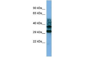 Host: Rabbit Target Name: CRYZL1 Sample Type: Jurkat Whole cell lysates Antibody Dilution: 1. (CRYZL1 Antikörper  (C-Term))