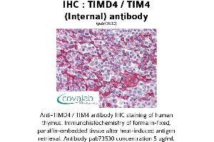 Image no. 2 for anti-T-Cell Immunoglobulin and Mucin Domain Containing 4 (TIMD4) (Internal Region) antibody (ABIN1740078) (TIMD4 Antikörper  (Internal Region))