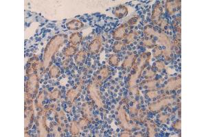 Used in DAB staining on fromalin fixed paraffin- embedded kidney tissue (MMP23A Antikörper  (AA 71-383))