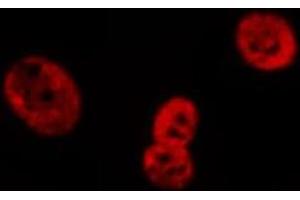 ABIN6269079 staining HeLa cells by IF/ICC. (Lamin A/C Antikörper  (Internal Region))