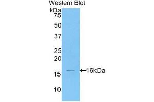 Detection of Recombinant HMGA2, Human using Polyclonal Antibody to High Mobility Group AT Hook Protein 2 (HMGA2) (HMGA2 Antikörper  (AA 1-109))
