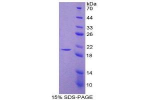 SDS-PAGE (SDS) image for Nitric Oxide Synthase 2, Inducible (NOS2) (AA 530-693) protein (His tag) (ABIN1980849)