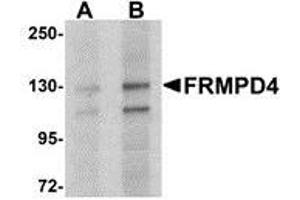 Western blot analysis of FRMPD4 in SK-N-SH cell lysate with AP30349PU-N FRMPD4 antibody at (A) 1 and (B) 2 μg/ml. (FRMPD4 Antikörper  (Center))