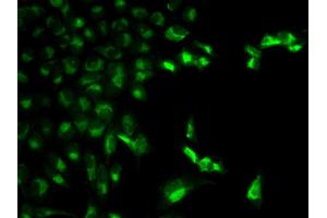 Immunofluorescence analysis of MCF-7 cell using FCGR1A antibody. (FCGR1A Antikörper  (AA 200-292))